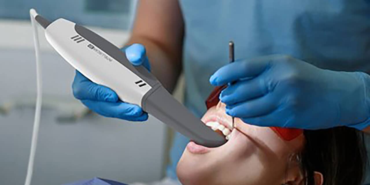 3D Intraoral Scanning